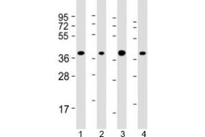 Western blot testing of human 1) HepG2, 2) Jurkat, 3) Li-7 and 4) RPMI-8226 cell lysate with ARHGEF39 antibody at 1:2000. (C9orf100 抗体  (AA 180-211))