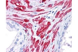 Stat5b antibody was used for immunohistochemistry at a concentration of 4-8 ug/ml. (STAT5B 抗体  (C-Term))