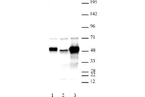 C17orf96 antibody (pAb) tested by Western blot. (C17ORF96 抗体  (AA 59-229))