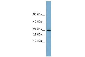 ERP29 antibody used at 1 ug/ml to detect target protein. (ERP29 抗体  (N-Term))