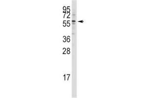 Western blot analysis of Tip60 antibody in Jurkat lysate (KAT5 抗体  (AA 33-64))