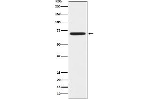 Western blot analysis of ZAP70 expression in Jurkat cell lysate.