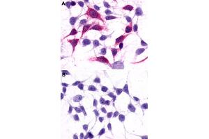 Immunocytochemistry (ICC) staining of HEK293 human embryonic kidney cells transfected (A) or untransfected (B) with GRM3. (Metabotropic Glutamate Receptor 3 抗体  (Extracellular Domain))