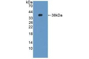 Detection of Recombinant DEFb2, Mouse using Polyclonal Antibody to Defensin Beta 2 (DEFb2) (beta 2 Defensin 抗体  (AA 21-71))