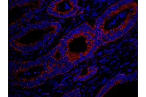 Immunofluorescence (IF) image for anti-MAP-Kinase Activating Death Domain (MADD) (AA 1597-1647) antibody (ABIN7448984) (MADD 抗体  (AA 1597-1647))