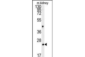 LHPL3 Antibody (C-term) (ABIN651908 and ABIN2840448) western blot analysis in mouse kidney tissue lysates (15 μg/lane). (LHFPL3 抗体  (C-Term))