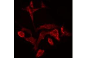 ABIN6278321 staining  COLO205 cells by IF/ICC. (SPTBN1 抗体  (N-Term))