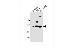 All lanes : Anti-M1 Antibody (Center) at 1:1000 dilution Lane 1: Human brain lysate Lane 2: PC-3 whole cell lysate Lane 3: U-251 MG whole cell lysate Lysates/proteins at 20 μg per lane. (AP1M1 抗体  (AA 205-234))