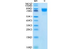 Rhesus macaque Complement Factor D on Tris-Bis PAGE under reduced condition. (Adipsin Protein (AA 21-253) (His tag))