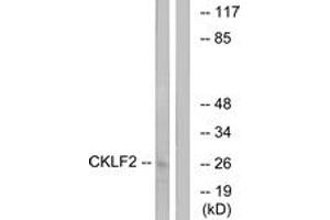 Western Blotting (WB) image for anti-CKLF-Like MARVEL Transmembrane Domain Containing 2 (CMTM2) (AA 171-220) antibody (ABIN2890220) (CMTM2 抗体  (AA 171-220))
