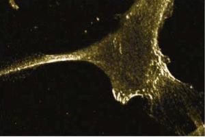 Immunofluorescent staining of Human Fibroblasts with anti-E-Cadherin antibody.