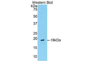 Western Blotting (WB) image for anti-Angiopoietin 1 (ANGPT1) (AA 304-450) antibody (ABIN3209767) (Angiopoietin 1 抗体  (AA 304-450))