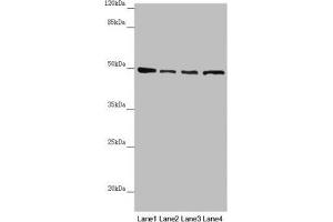 Western blot All lanes: AP1M1 antibody at 1. (AP1M1 抗体  (AA 1-160))