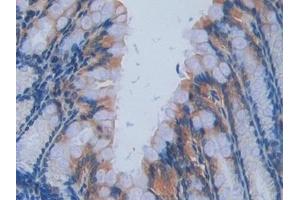 Detection of IL17RA in Mouse Intestine Tissue using Polyclonal Antibody to Interleukin 17 Receptor A (IL17RA) (IL17RA 抗体  (AA 590-848))
