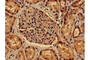 Immunohistochemistry of paraffin-embedded human kidney tissue using ABIN7162722 at dilution of 1:100 (PDLIM2 抗体  (AA 161-284))