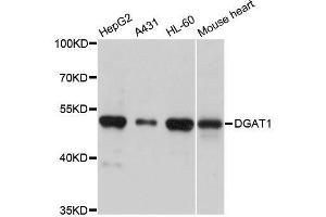 Western blot analysis of extracts of various cell lines, using DGAT1 antibody. (DGAT1 抗体  (AA 200-300))