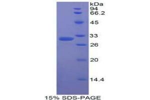 SDS-PAGE analysis of Human Karyopherin alpha 2 Protein. (KPNA2 蛋白)