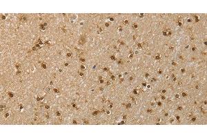 Immunohistochemistry of paraffin-embedded Human brain using RNH1 Polyclonal Antibody at dilution of 1:40 (RNH1 抗体)