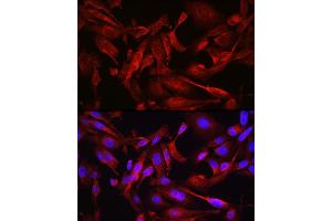 Immunofluorescence analysis of U2OS cells using ST Rabbit pAb (ABIN6128541, ABIN6148581, ABIN6148582 and ABIN6213980) at dilution of 1:200 (40x lens). (STAT6 抗体  (AA 1-180))