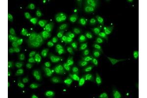 Immunofluorescence analysis of A-549 cells using SMYD3 antibody (ABIN6128709, ABIN6148169, ABIN6148170 and ABIN6223146). (SMYD3 抗体  (AA 140-369))