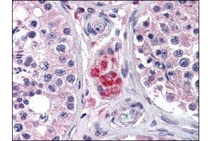 Immunohistochemistry Image: Human Testis: Formalin-Fixed, Paraffin-Embedded (FFPE) (PPARD 抗体  (C-Term))