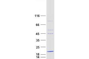 Western Blotting (WB) image for Chromosome 20 Open Reading Frame 30 (C20orf30) (Transcript Variant 3) protein (Myc-DYKDDDDK Tag) (ABIN2715475)