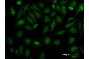 Immunofluorescence of monoclonal antibody to FH on HeLa cell. (FH 抗体  (AA 33-510))