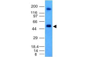 Image no. 2 for anti-Carbonic Anhydrase IX (CA9) antibody (ABIN6182201) (CA9 抗体)