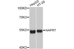 Western blot analysis of extracts of various cell lines, using NAPRT Antibody (ABIN4904492) at 1:3000 dilution. (NAPRT1 抗体)