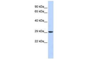 Image no. 1 for anti-Proteasome Subunit Alpha Type 3 (PSMA3) (C-Term) antibody (ABIN6744210) (PSMA3 抗体  (C-Term))