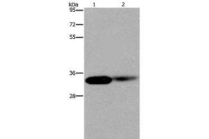 Western Blot analysis of Human kidney and Mouse lung tissue using LIMS1 Polyclonal Antibody at dilution of 1:200 (LIMS1 抗体)