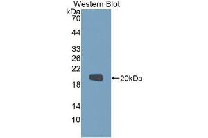 Western blot analysis of recombinant Human MMP9. (MMP 9 抗体  (AA 213-399))