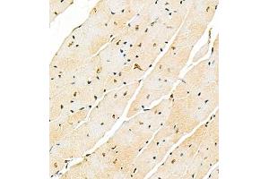 Immunohistochemistry (Paraffin-embedded Sections) (IHC (p)) image for anti-Survival Motor Neuron Domain Containing 1 (SMNDC1) antibody (ABIN7075773)