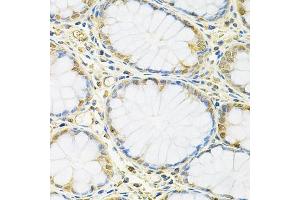 Immunohistochemistry of paraffin-embedded human colon using FMRP Antibody (ABIN6127908, ABIN6140718, ABIN6140720 and ABIN6221284) at dilution of 1:100 (40x lens). (FMR1 抗体  (AA 1-290))