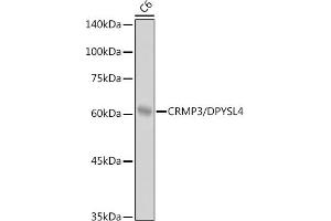 Western blot analysis of extracts of C6 cells, using CRMP3/DPYSL4 antibody (ABIN7266772) at 1:1000 dilution. (DPYSL4 抗体)