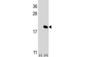Western blot analysis of IL-17 antibody and 293 cell lysate (2 ug/lane) either nontransfected (Lane 1) or transiently transfected (2) with the IL17A gene. (Interleukin 17a 抗体  (AA 61-87))