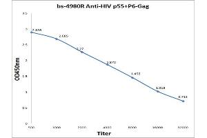 Antigen: 0. (Hiv P55+P6-Gag 抗体)