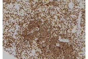 ABIN6260675 and ABIN6276576 at 1/100 staining Rat spleen tissue by IHC-P. (CDC25A 抗体  (N-Term))