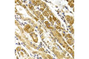 Immunohistochemistry of paraffin-embedded human stomach using BMP15 antibody at dilution of 1:100 (x40 lens). (BMP15 抗体)