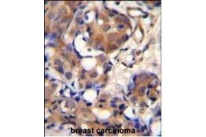 Immunohistochemistry (Paraffin-embedded Sections) (IHC (p)) image for anti-Kininogen 1 (KNG1) (AA 138-166), (N-Term) antibody (ABIN655629)