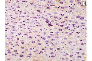 Formalin-fixed and paraffin embedded mouse liver labeled with Anti-SRRM2 Polyclonal Antibody, Unconjugated  at 1:200 followed by conjugation to the secondary antibody and DAB staining. (SRRM2 抗体  (AA 101-230))