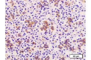 Formalin-fixed and paraffin embedded human pancreas labeled with Anti-TROP2/TACD2 Polyclonal Antibody, Unconjugated (ABIN715646) at 1:200 followed by conjugation to the secondary antibody and DAB staining (TACSTD2 抗体  (AA 221-322))