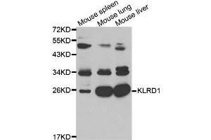 Western blot analysis of extracts of K562 cell lines, using KLRD1 antibody. (CD94 抗体  (AA 32-179))