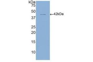 WB of Protein Standard: different control antibodies  against Highly purified E. (CD4 ELISA 试剂盒)