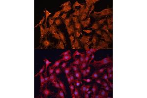 Immunofluorescence analysis of C6 cells using P Glycoprotein antibody (ABIN6129943, ABIN6136341, ABIN6136344 and ABIN6216612) at dilution of 1:100.