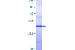 Image no. 1 for Guanylate Cyclase 2C (Heat Stable Enterotoxin Receptor) (GUCY2C) (AA 24-133) protein (GST tag) (ABIN1306220)