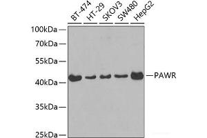 Western blot analysis of extracts of various cell lines using PAWR Polyclonal Antibody at dilution of 1:400. (PAWR 抗体)