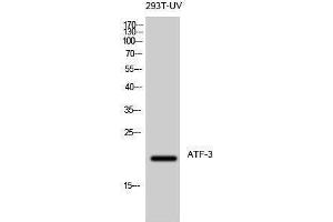 Western Blotting (WB) image for anti-Activating Transcription Factor 3 (ATF3) (C-Term) antibody (ABIN3183418) (ATF3 抗体  (C-Term))
