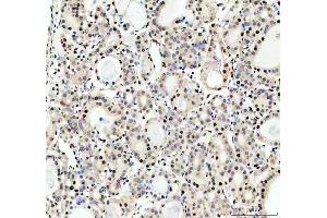 IHC analysis of HRAD50 using anti-RAD50 antibody (ABIN7599857).