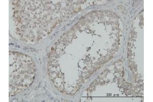 Image no. 1 for anti-Mitogen-Activated Protein Kinase Kinase Kinase 4 (MAP3K4) (AA 1201-1300) antibody (ABIN598811) (MAP3K4 抗体  (AA 1201-1300))